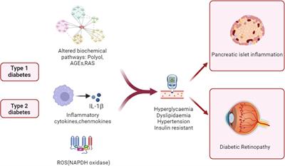 The role of inflammation in immune system of diabetic retinopathy: Molecular mechanisms, pathogenetic role and therapeutic implications